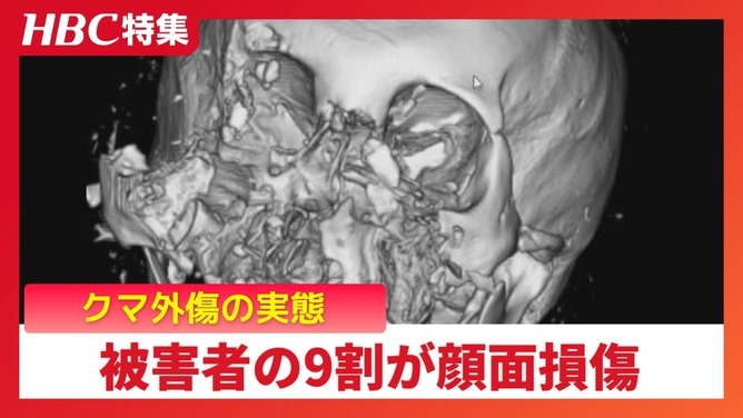 【悲報】最近のクマ、死んだフリ作戦でハンター返り討ちｗｗｗｗｗ