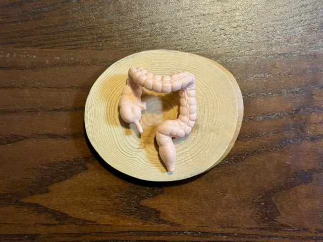 大腸カメラしてきたけどマジでヤバかった