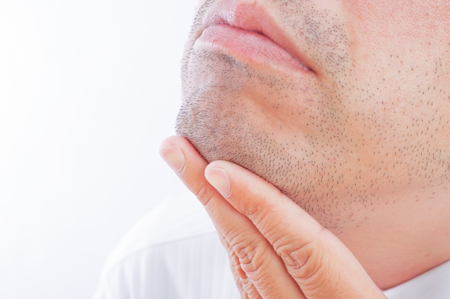 【朗報】初めてのヒゲ脱毛して10日、ほぼ全ての毛が抜け落ちるｗｗｗｗｗｗ